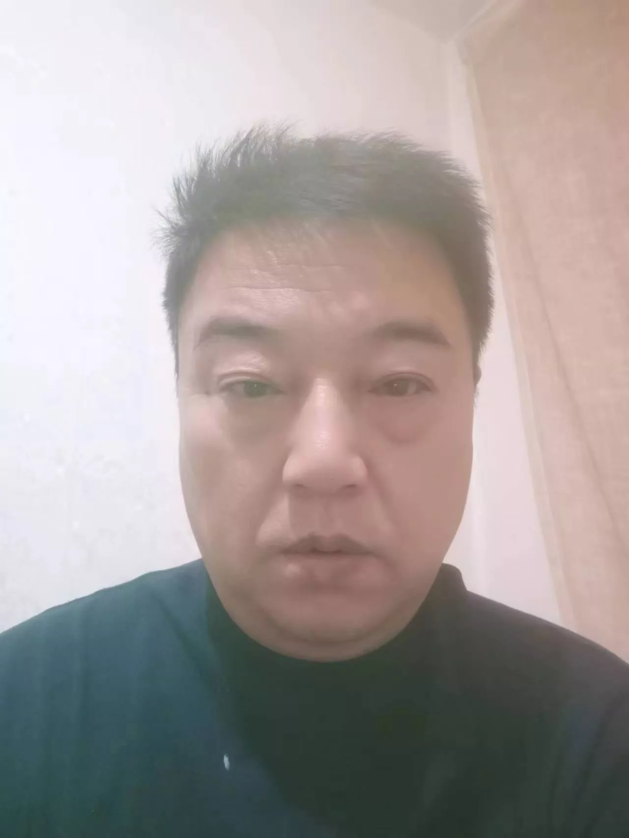 山东省，郯城县【孙同江】特长：中药内服治疗胃病肠炎
