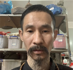 广西省、巴马【包燕辉】乳腺癌，胃癌，肺癌，肝癌，前列腺癌等各种恶性肿瘤以及各种慢性疾病