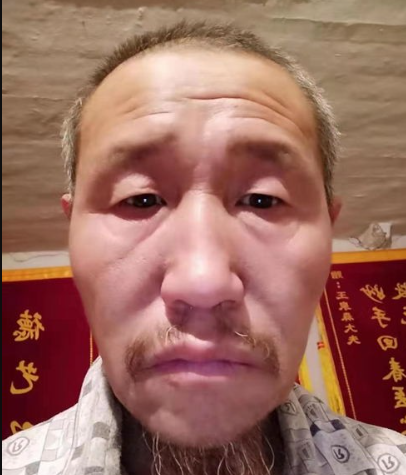 内蒙古、呼伦贝尔【王泉森】中风后医症，脑血栓，脑出血后医症同步治疗风温，类风湿等