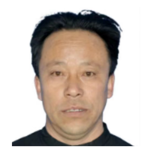 内蒙古、乌兰察布【李文举】颈椎病，肾脏病，慢性前列腺炎、荨麻疹，高血压，糖尿病