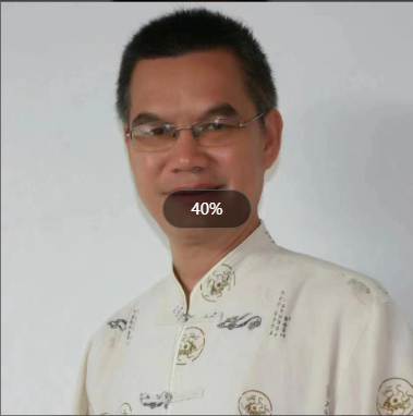 广东、清远【朱励云】牙痛、痔疮、颈肩腰腿痛、富贵包、老年痴呆症、长期头晕头痛