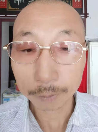 内蒙古【李双泉】治疗结肠炎